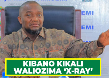 KIBANO KIKALI WALIOZIMA ‘X-RAY’ TEMEKE