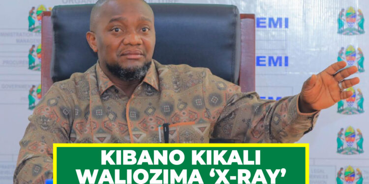 KIBANO KIKALI WALIOZIMA ‘X-RAY’ TEMEKE