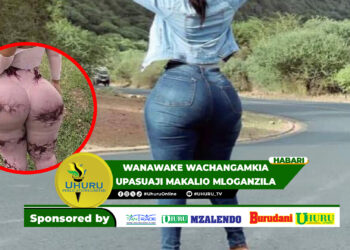 WANAWAKE WACHANGAMKIA UPASUAJI MAKALIO MLOGANZILA