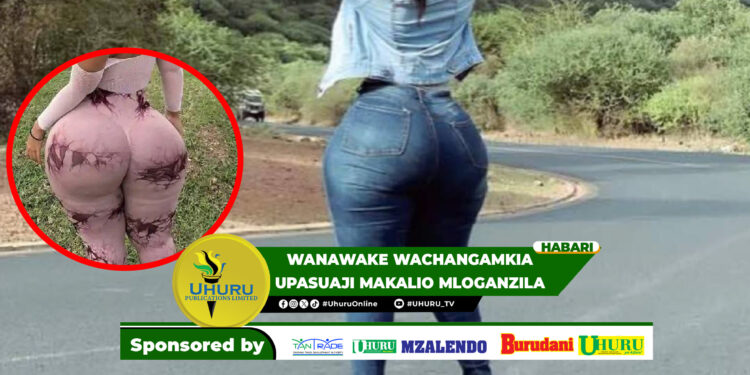 WANAWAKE WACHANGAMKIA UPASUAJI MAKALIO MLOGANZILA