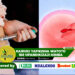 KAIRUKI YAFIKISHA WATOTO 160 UPANDIKIZAJI MIMBA